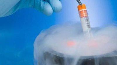 私人医院试管收费如何(私人医院做试管婴儿有什么风险)